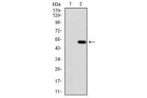 Image no. 1 for anti-Protein Phosphatase, Mg2+/Mn2+ Dependent, 1A (PPM1A) antibody (ABIN1491178) (PPM1A Antikörper)