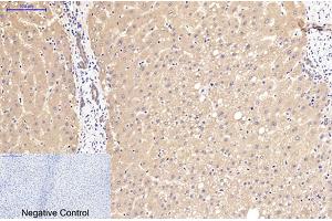 Immunohistochemical analysis of paraffin-embedded human liver tissue. (beta Catenin Antikörper)