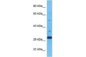 Host:  Rabbit  Target Name:  ELOV1  Sample Type:  Stomach Tumor lysates  Antibody Dilution:  1. (ELOVL1 Antikörper  (N-Term))