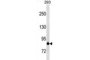 Western Blotting (WB) image for anti-K-Cadherin (CDH6) antibody (ABIN2997776) (CDH6 Antikörper)