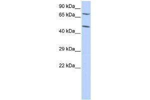 WB Suggested Anti-ZNF672 Antibody Titration:  0. (ZNF672 Antikörper  (Middle Region))