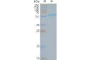 Human MA-Nanodisc, Flag Tag on SDS-PAGE (TMEM180 Protein)