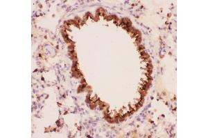 Anti-Annexin A1 Picoband antibody,  IHC(P): Rat Lung Tissue (Annexin a1 Antikörper  (AA 2-346))