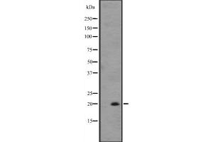 Western blot analysis of IL25 expression in ZR-75-1 cell line lysates ,The lane on the left is treated with the antigen-specific peptide. (IL-25 Antikörper  (Internal Region))