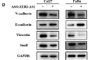 Western Blotting (WB) image for anti-Vimentin (VIM) antibody (ABIN2854814)