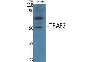 Western Blotting (WB) image for anti-TNF Receptor-Associated Factor 2 (TRAF2) (Internal Region) antibody (ABIN3177779) (TRAF2 Antikörper  (Internal Region))
