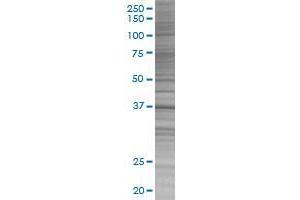 BOLL transfected lysate. (BOLL 293T Cell Transient Overexpression Lysate(Denatured))