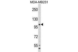 Image no. 1 for anti-Complement Component 6 (C6) (N-Term) antibody (ABIN452791) (C6 Antikörper  (N-Term))
