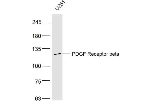 PDGFRB Antikörper  (AA 981-1066)