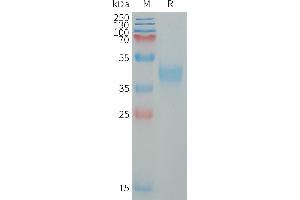 Human M Protein, His Tag on SDS-PAGE under reducing condition. (MXRA8 Protein (AA 20-340) (His tag))