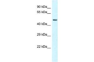 Western Blot showing GC antibody used at a concentration of 1 ug/ml against 721_B Cell Lysate (Gc (N-Term) Antikörper)