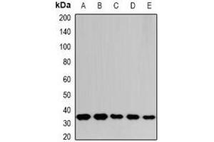 Western blot analysis of THOC1 expression in SHSY5Y (A), SW620 (B), NIH3T3 (C), mouse spleen (D), rat liver (E) whole cell lysates. (THOC1 Antikörper)