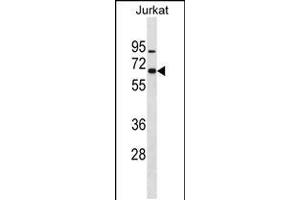 Western blot analysis in Jurkat cell line lysates (35ug/lane). (ZNF358 Antikörper  (N-Term))