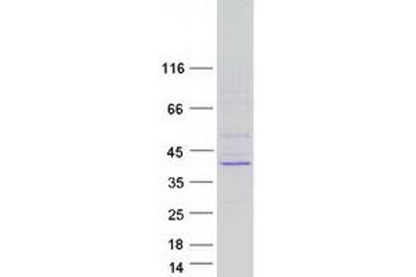 Nth Endonuclease III-Like 1 (NTHL1) protein (Myc-DYKDDDDK Tag)