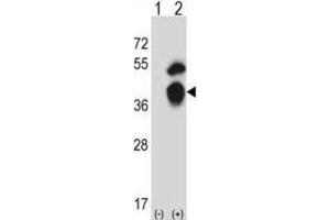 Western Blotting (WB) image for anti-General Transcription Factor IIB (GTF2B) antibody (ABIN2997924) (GTF2B Antikörper)