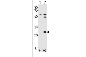 Western blot analysis of STAP1 using rabbit polyclonal STAP1 Antibody (F56) using 293 cell lysates (2 ug/lane) either nontransfected (Lane 1) or transiently transfected (Lane 2) with the STAP1 gene. (STAP1 Antikörper  (N-Term))