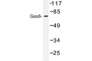 Image no. 1 for anti-Growth Arrest-Specific 6 (GAS6) antibody (ABIN317613) (GAS6 Antikörper)