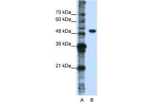 WB Suggested Anti-DDX47 Antibody Titration:  0. (DDX47 Antikörper  (N-Term))