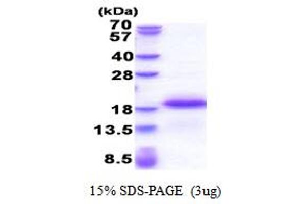 EAF1 Protein (AA 182-268) (His tag)