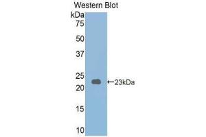 Western Blotting (WB) image for anti-phosphorylase, Glycogen, Liver (PYGL) (AA 341-509) antibody (ABIN1173786) (PYGL Antikörper  (AA 341-509))