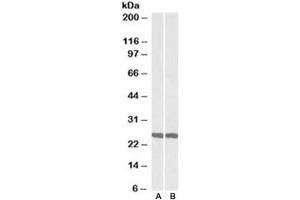 Western blot testing of mouse [A] and rat [B] brain lysate with UCHL1 antibody at 0. (UCHL1 Antikörper)