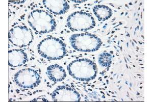 Immunohistochemical staining of paraffin-embedded colon tissue using anti-CHEK2mouse monoclonal antibody. (CHEK2 Antikörper)