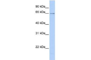 WB Suggested Anti-PPIL2 Antibody Titration: 0. (PPIL2 Antikörper  (C-Term))