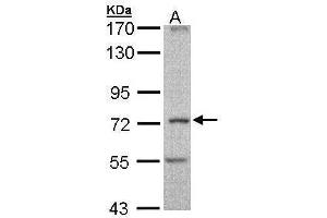 WB Image Sample (30 ug of whole cell lysate) A: Molt-4 , 7. (DNAI2 Antikörper  (C-Term))