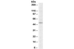 Western blot testing of K562 lysate with TRIP6 antibody at 2ug/ml. (TRIP6 Antikörper)
