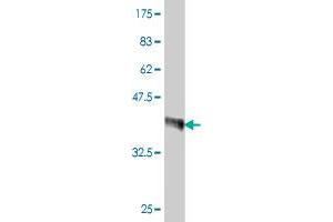 Western Blot detection against Immunogen (35. (SHOX2 Antikörper  (AA 117-204))