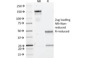 Immunofluorescence (IF) image for anti-Membrane-Spanning 4-Domains, Subfamily A, Member 1 (MS4A1) antibody (ABIN6941111)