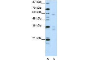 WB Suggested Anti-ZNF440 Antibody Titration:  2. (ZNF440 Antikörper  (N-Term))