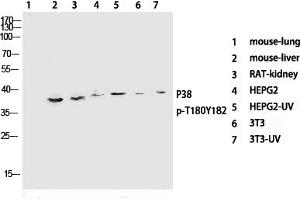 Western Blotting (WB) image for anti-Mitogen-Activated Protein Kinase 14 (MAPK14) (pThr180), (pTyr182) antibody (ABIN5955628) (MAPK14 Antikörper  (pThr180, pTyr182))