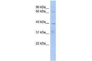WB Suggested Anti-KHDRBS2 Antibody Titration: 0. (KHDRBS2 Antikörper  (Middle Region))