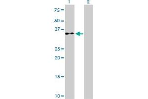 Western Blotting (WB) image for anti-Eukaryotic Translation Initiation Factor 2 Subunit 1 (EIF2S1) (AA 1-315) antibody (ABIN560711)