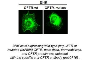 Image no. 1 for anti-Cystic Fibrosis Transmembrane Conductance Regulator (ATP-Binding Cassette Sub-Family C, Member 7) (CFTR) (N-Term) antibody (ABIN559719) (CFTR Antikörper  (N-Term))