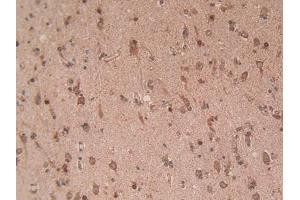 IHC-P analysis of Human Brain Tissue, with DAB staining. (EZH2 Antikörper  (AA 51-285))