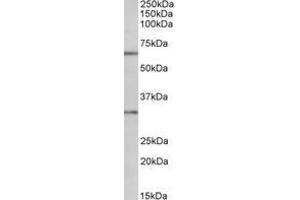 Image no. 1 for anti-Caspase 3 (CASP3) (AA 101-112) antibody (ABIN1100424) (Caspase 3 Antikörper  (AA 101-112))