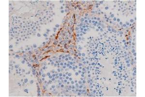 ABIN6267471 at 1/200 staining Mouse testis tissue sections by IHC-P. (AKT1 Antikörper  (pSer124))