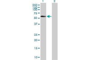 Western Blot analysis of STK11 expression in transfected 293T cell line by STK11 MaxPab polyclonal antibody. (LKB1 Antikörper  (AA 1-433))