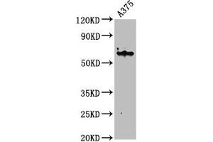 Western Blot Positive WB detected in: A375 whole cell lysate All lanes: KRT6A antibody at 4. (KRT6A Antikörper  (AA 2-564))