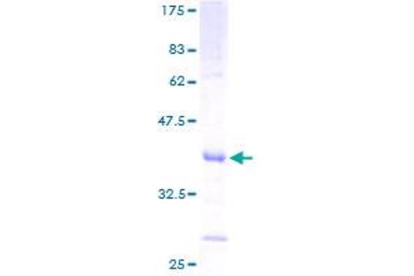 SLPI Protein (AA 26-132) (GST tag)