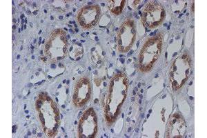 Immunohistochemical staining of paraffin-embedded Human Kidney tissue using anti-C21orf56 mouse monoclonal antibody. (C21ORF56 Antikörper)