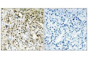 Immunohistochemistry (IHC) image for anti-Periphilin 1 (PPHLN1) (Internal Region) antibody (ABIN1849790) (PPHLN1 Antikörper  (Internal Region))