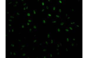 Immunofluorescence (IF) image for anti-Poly A Binding Protein Nuclear 1 (PABPN1) antibody (ABIN7127661)