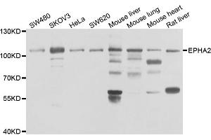 Western blot analysis of extracts of various cell lines, using EPHA2 antibody (ABIN5975494) at 1/1000 dilution. (EPH Receptor A2 Antikörper)