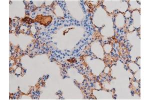 ABIN6267471 at 1/200 staining Mouse lung tissue sections by IHC-P. (AKT1 Antikörper  (pSer124))