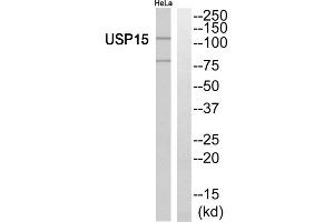 Western blot analysis of extracts from HeLa cells, using USP15 antibody. (USP15 Antikörper  (N-Term))