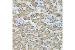 Immunohistochemistry of paraffin-embedded human liver injury using PHF1 antibody (ABIN5974685) at dilution of 1/100 (40x lens). (PHF1 Antikörper)