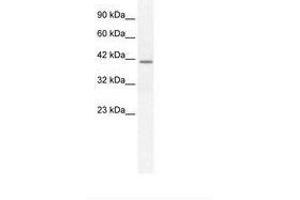 Image no. 1 for anti-Secreted phosphoprotein 1 (SPP1) (C-Term) antibody (ABIN203280) (Osteopontin Antikörper  (C-Term))